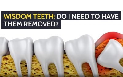 Wisdom Teeth: Do I Need to Have Them Removed?