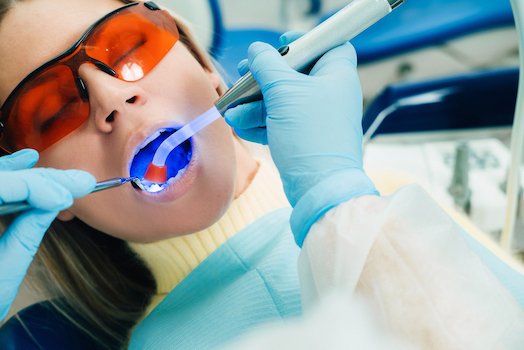 dental bonding material used melbourne cbd