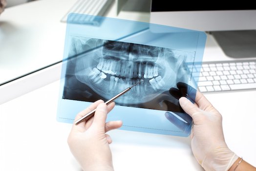 dental x-rays melbourne cbd