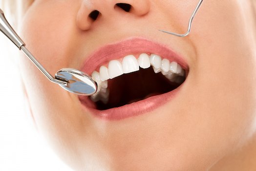 tooth fillings blurb melbourne cbd