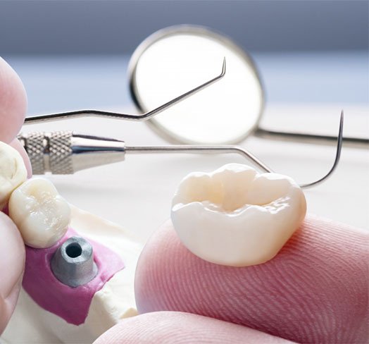 what to do in case of lost and damaged dental restorations