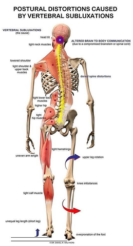 tmd symptoms and signs 3 melbourne cbd