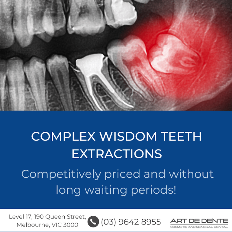 complex wisdom teeth extraction banner dentist melbourne cbd