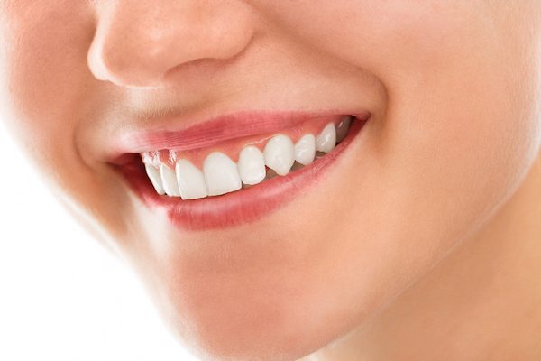 white spots on teeth treatment melbourne cbd